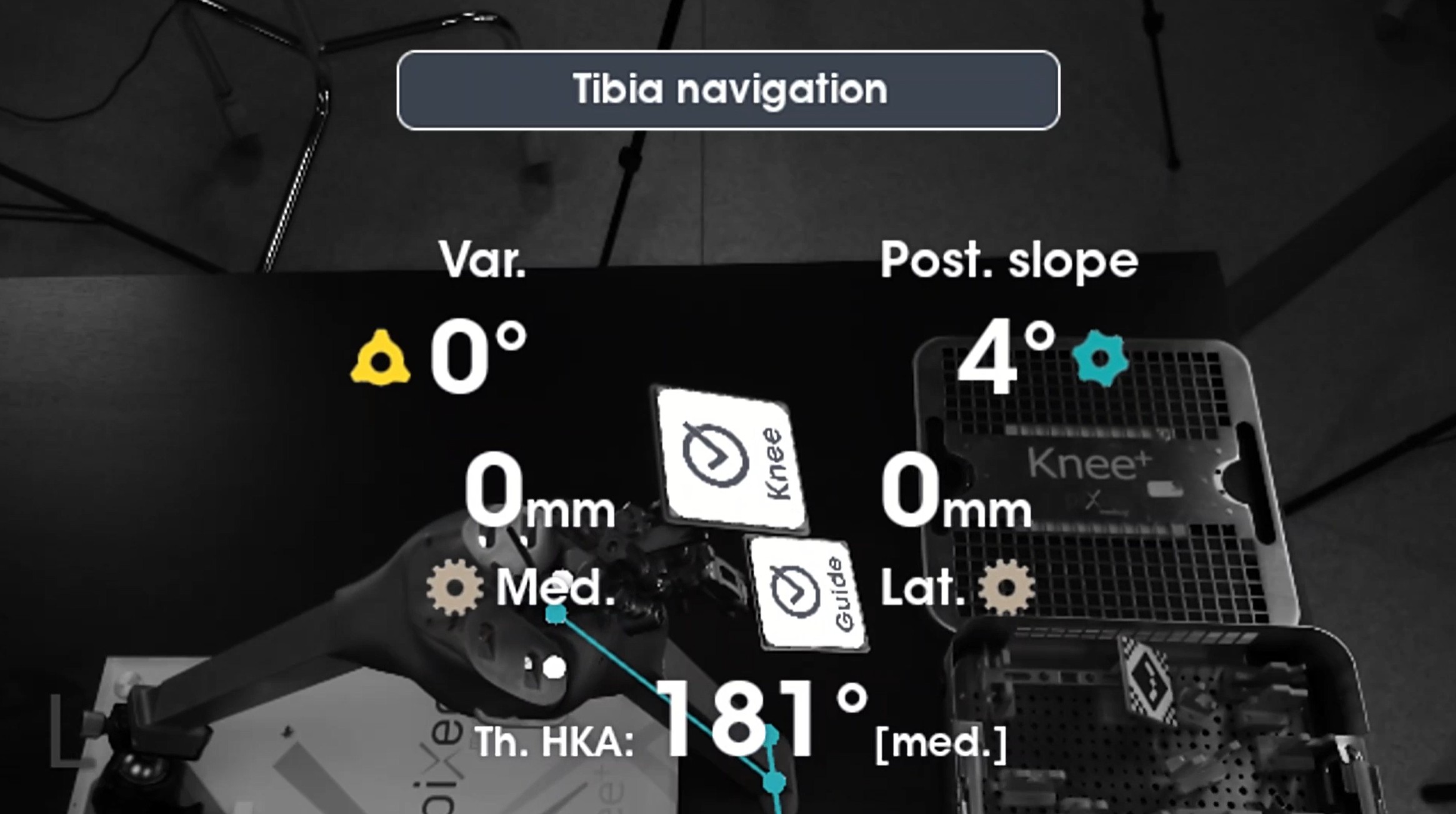 The Solution: Built with OAK